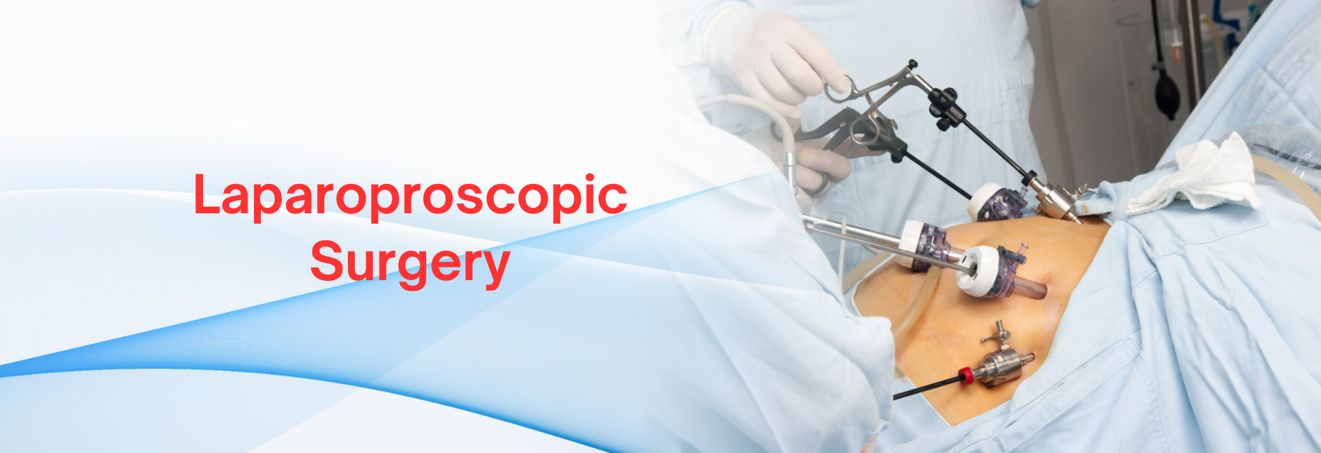 Laparoproscopic Surgery